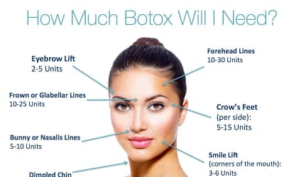 Why Botox?